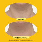TL Advanced™  Tightening Neck Cream PLUS with Alpha-3 Peptide ™